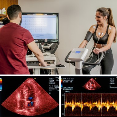 Corvin főorvosi kardiológiai csomag: Alapvizsgálatok + Szívultrahang (ECHO) + Nyugalmi EKG + Terheléses EKG* + Kiértékelés, és konzultáció