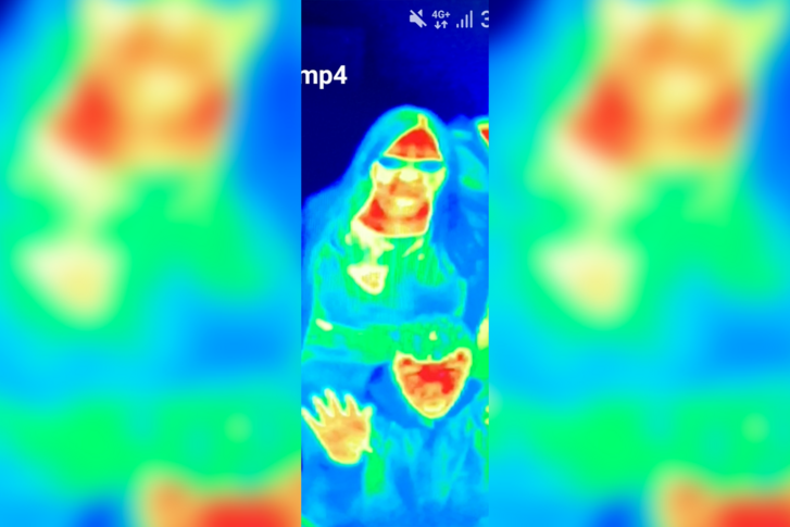 Termokamerás totál látlelet a szervezetedről: Orvosi termográfiás állapotfelmérés, konzultációval Budapesten és Győrben