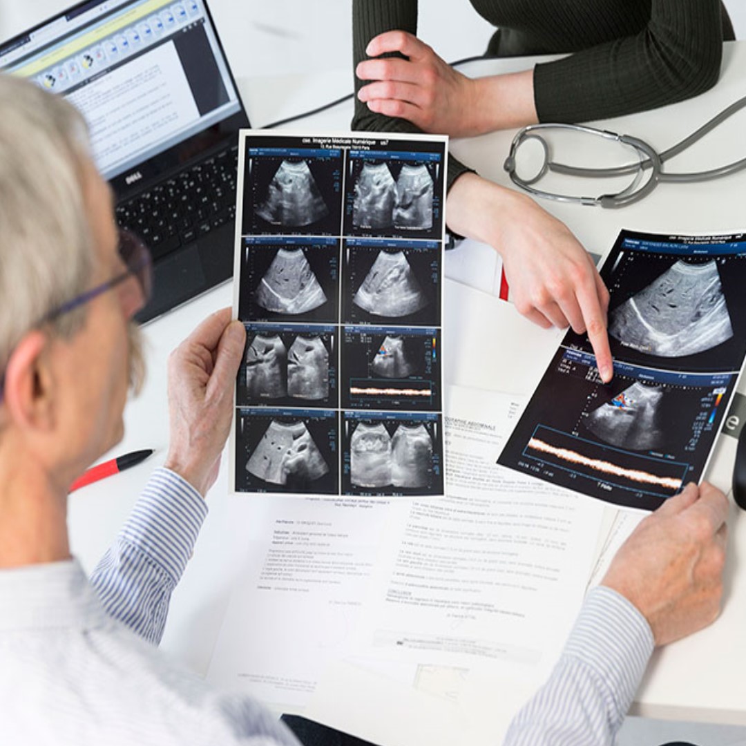 Átfogó ultrahang szűrőcsomag Férfiaknak: Hasi ultrahang vizsgálat (máj, epe, vese, lép, hasnyálmirigy) + Pajzsmirigy UH + Nyaki erek UH (trombózis, stroke megelőzés)