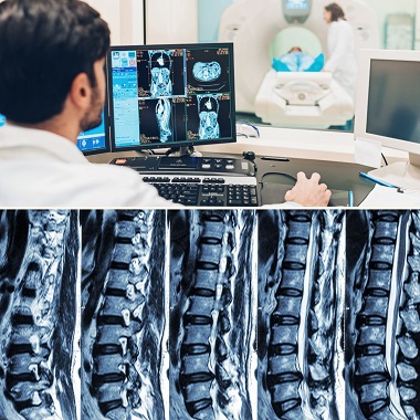 Gerinc MR vizsgálat nyaki-háti- vagy farokcsonti. Gerinc fájdalmak, szédüléses panaszok, kar és láb zsibbadás, lumbágós panaszok esetén  a betegbarát Radivert MR Klinikán, 1.5 T GE MRI készülékkel